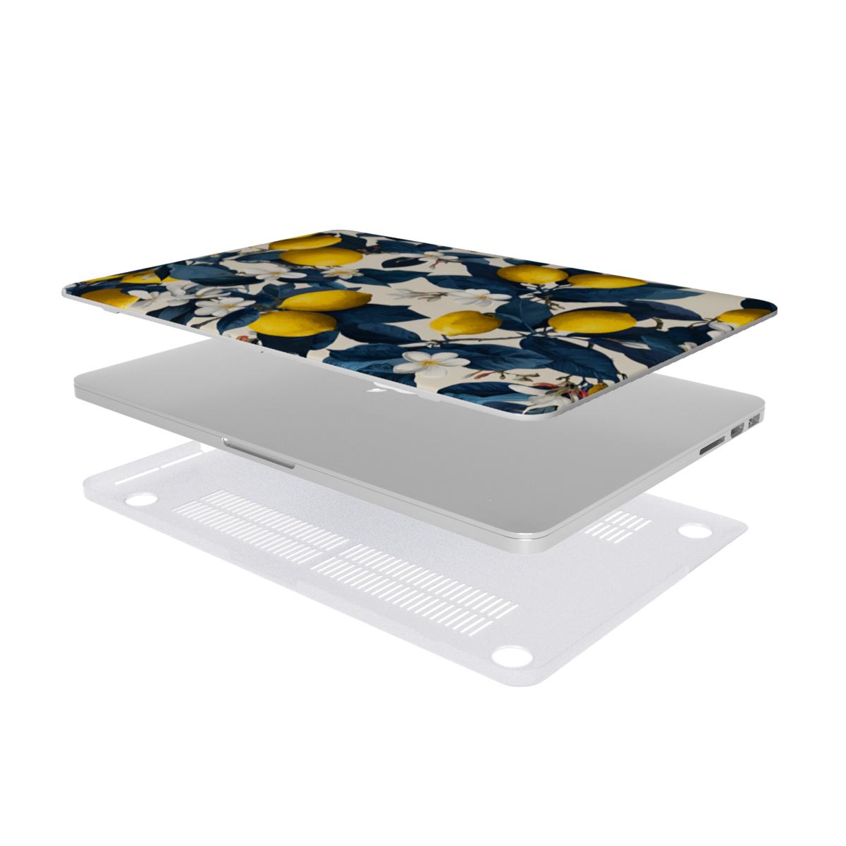 Lemonade - MacBook Case